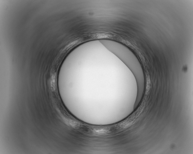 X0000099290360200805020739