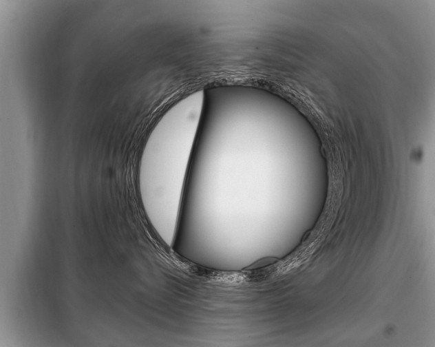 X0000099290576200805020736