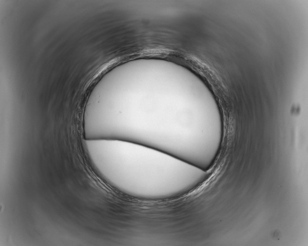 X0000099291401200805020722