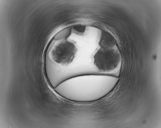 X0000099291487200805020721