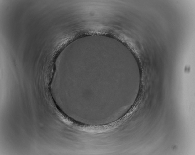 X0000099290017200805021242