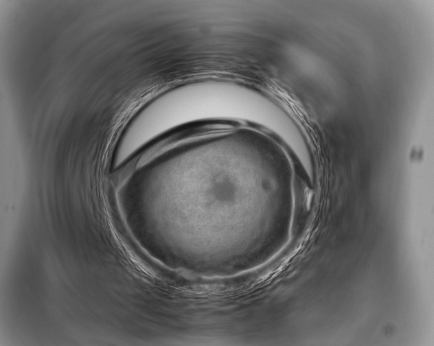X0000099290049200805021241