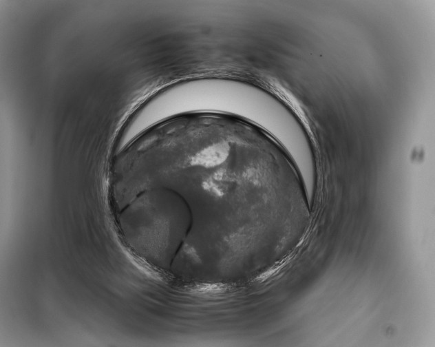 X0000099290059200805021241