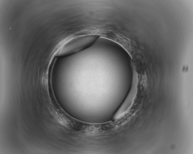 X0000099290148200805021239