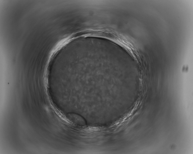 X0000099290149200805021239