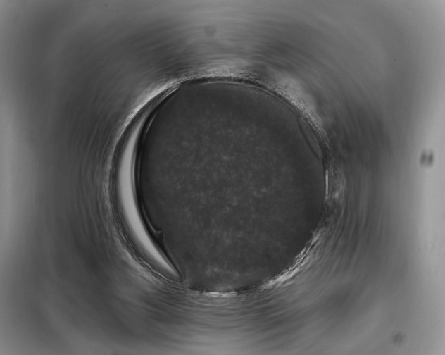 X0000099290156200805021239