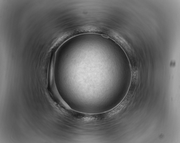 X0000099290158200805021239