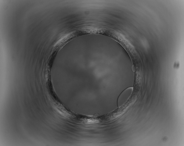 X0000099290165200805021239