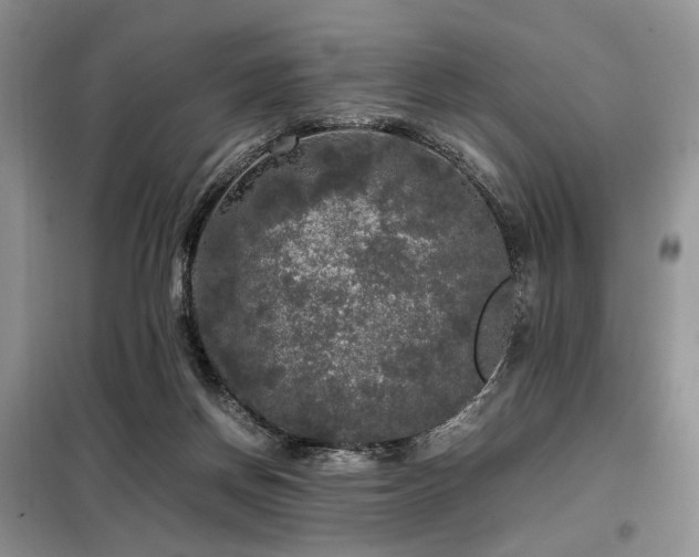 X0000099290166200805021239