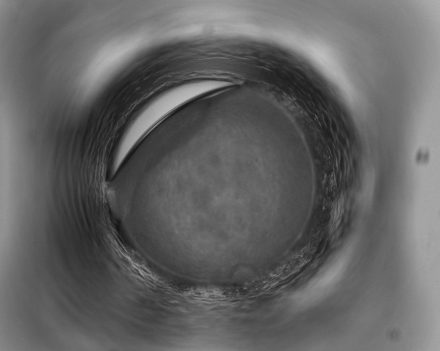 X0000099290194200805021239
