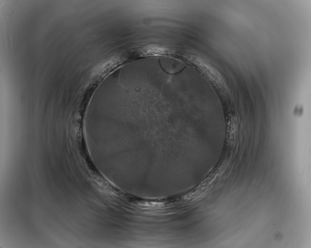 X0000099290361200805021237