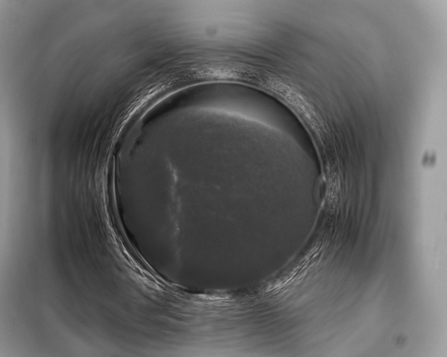 X0000099290386200805021236