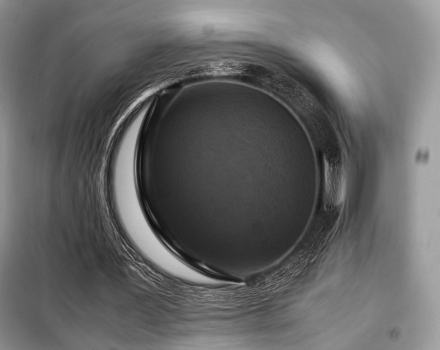 X0000099290387200805021236