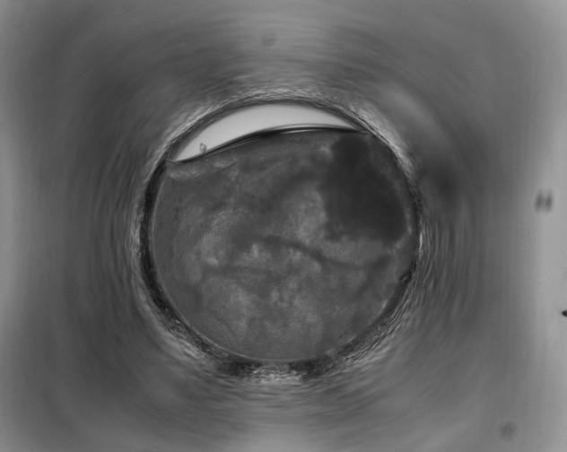 X0000099290491200805021235