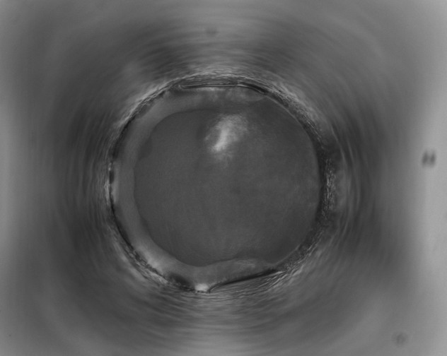 X0000099290592200805021233
