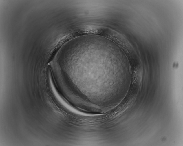 X0000099290600200805021233