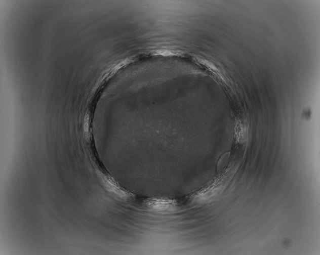 X0000099290670200805021233