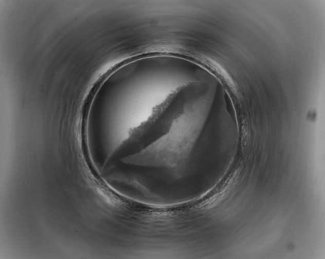 X0000099291035200805021227