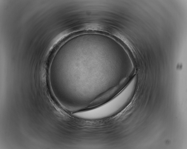 X0000099291115200805021225
