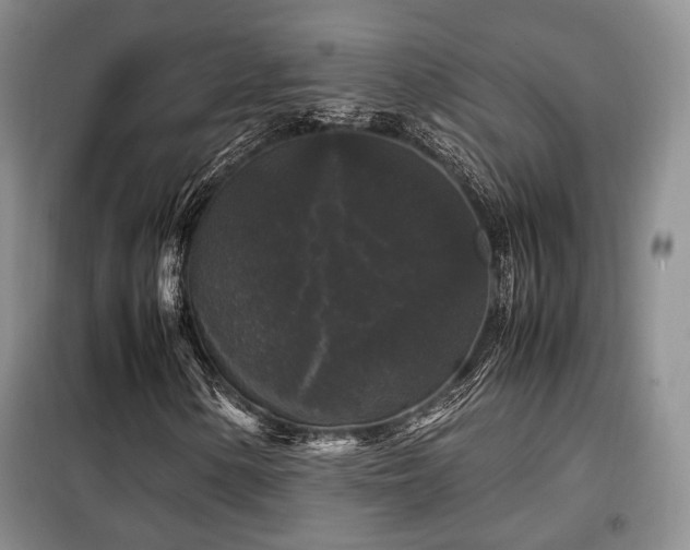 X0000099291154200805021225