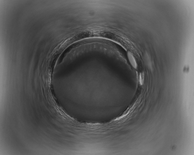 X0000099291155200805021225