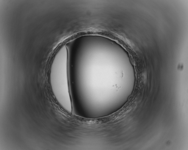 X0000099291160200805021225