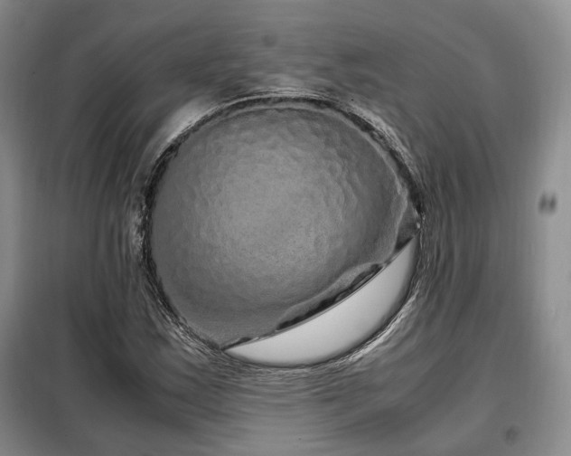 X0000099291163200805021225