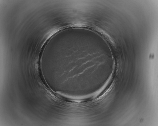 X0000099291170200805021225