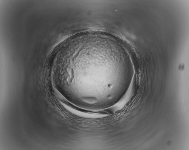 X0000099291255200805021223