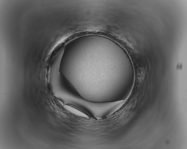 X0000099291256200805021223
