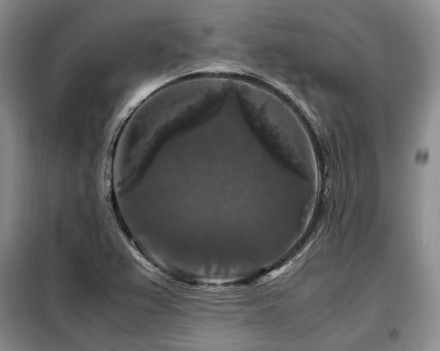 X0000099291367200805021222