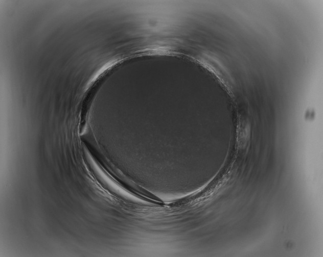 X0000099291450200805021220