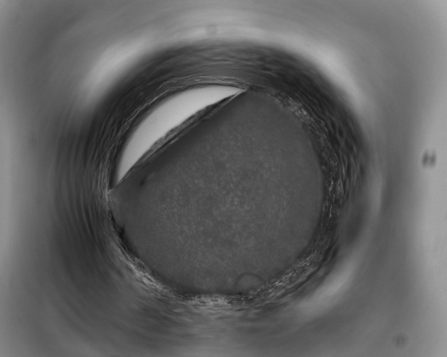 X0000099290194200805090939