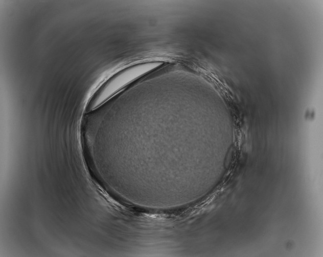 X0000099290244200805090937