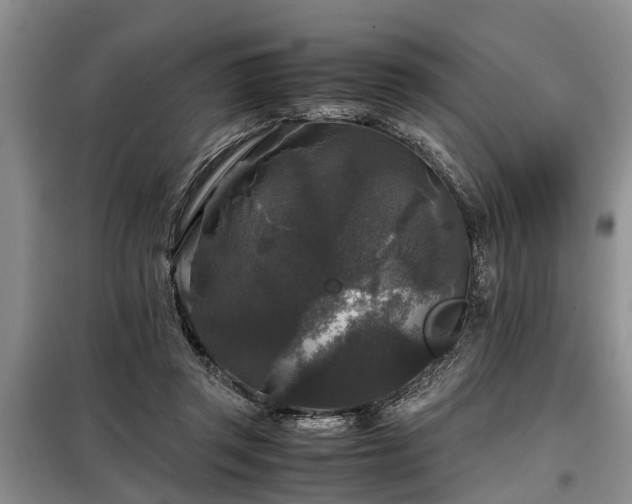 X0000099290357200805090936