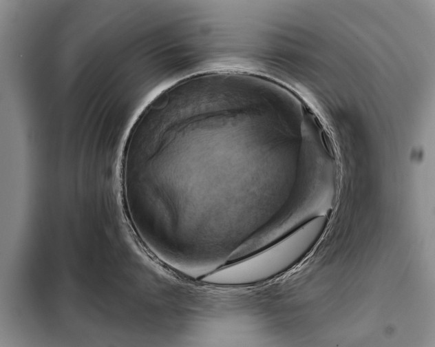 X0000099290864200805090929