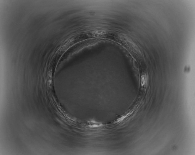 X0000099291011200805090925