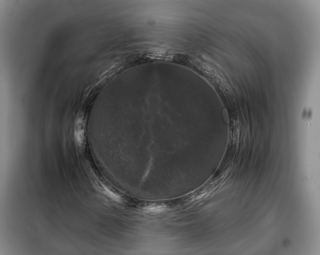 X0000099291154200805090923
