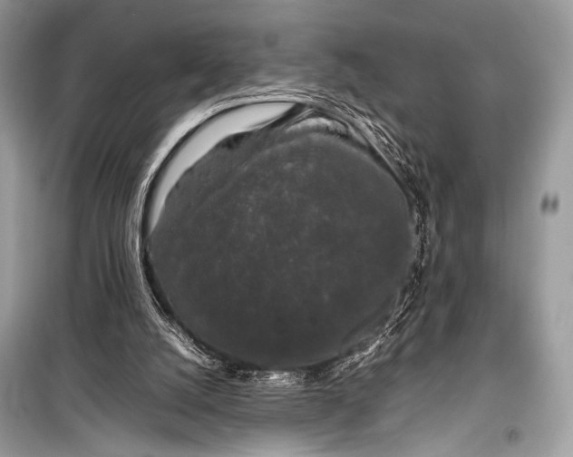 X0000099290056200805161335