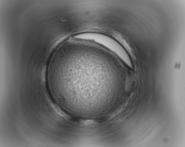 X0000099290058200805161335