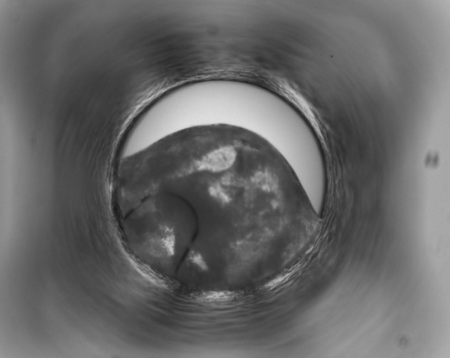 X0000099290059200805161335