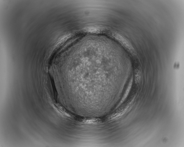 X0000099290072200805161335