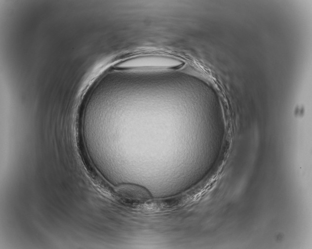 X0000099290103200805161335