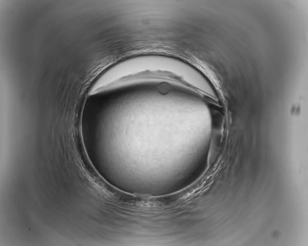 X0000099290105200805161335