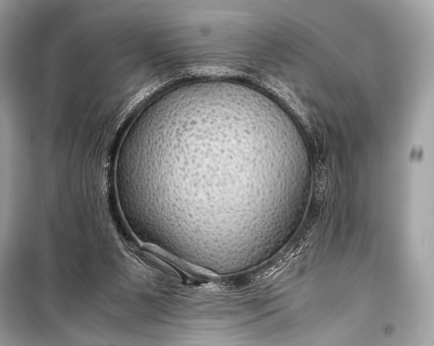 X0000099290111200805161335