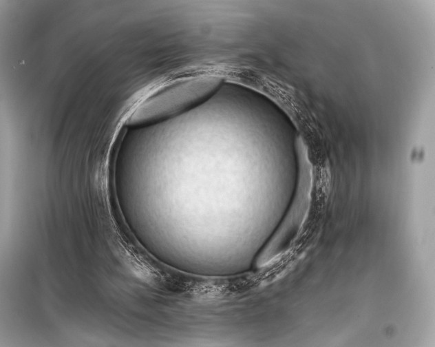 X0000099290148200805161333