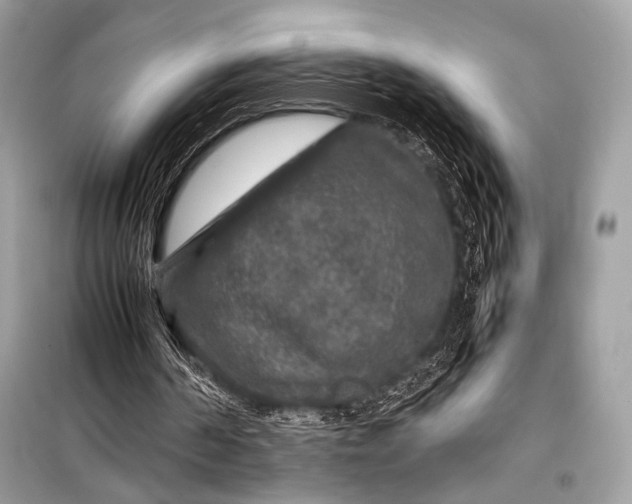 X0000099290194200805161333