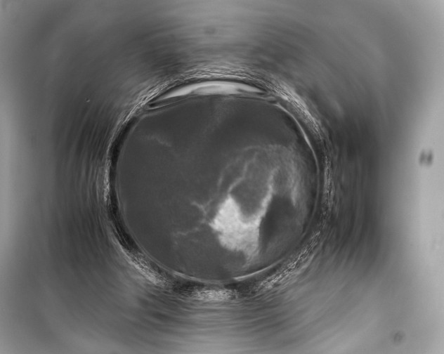 X0000099290202200805161333