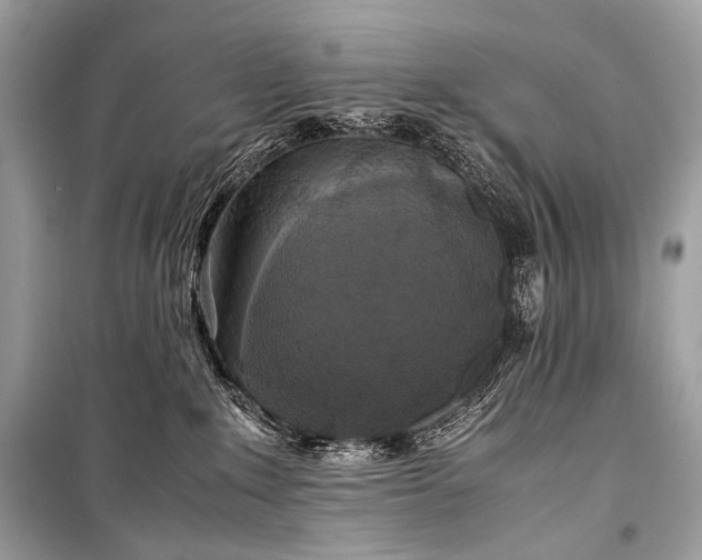 X0000099290235200805161332