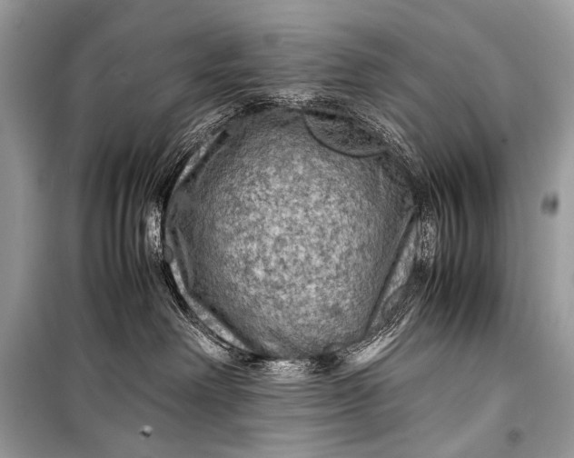 X0000099290238200805161332